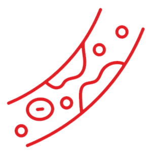 Arteriosclerosis